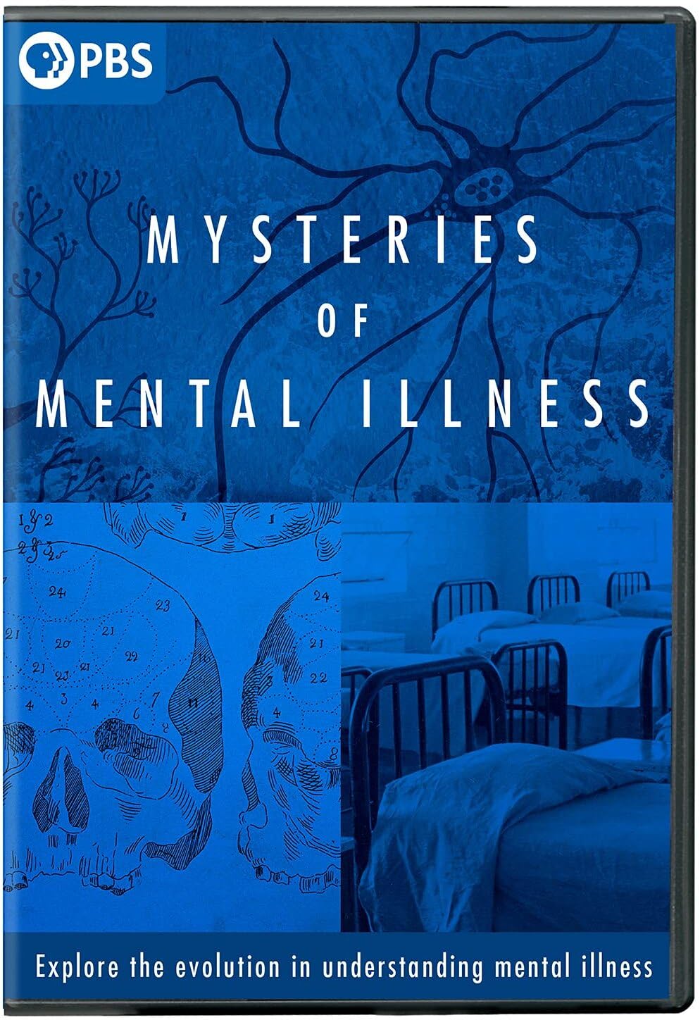 The Mysteries of Mental Illness (DVD)