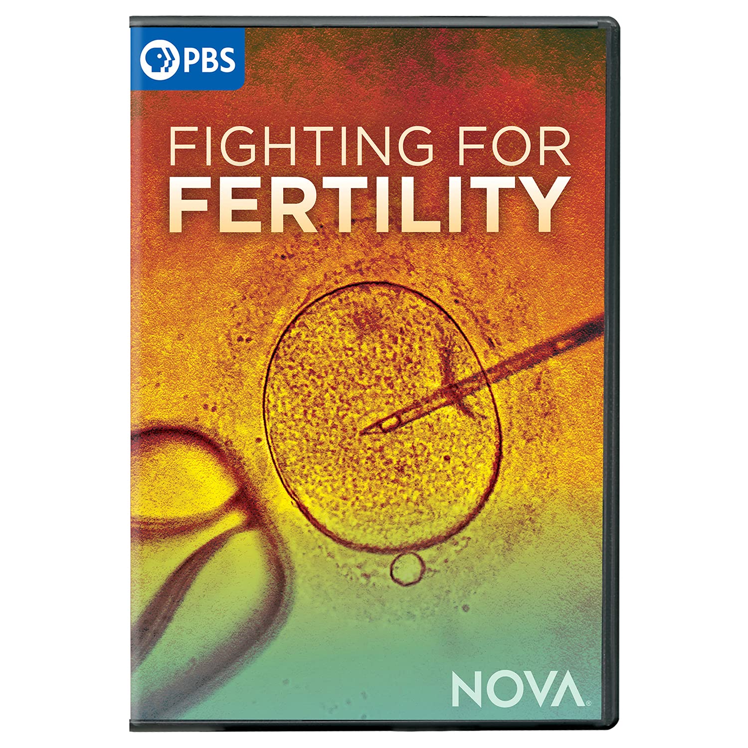 Nova: Fighting for Fertility (DVD)