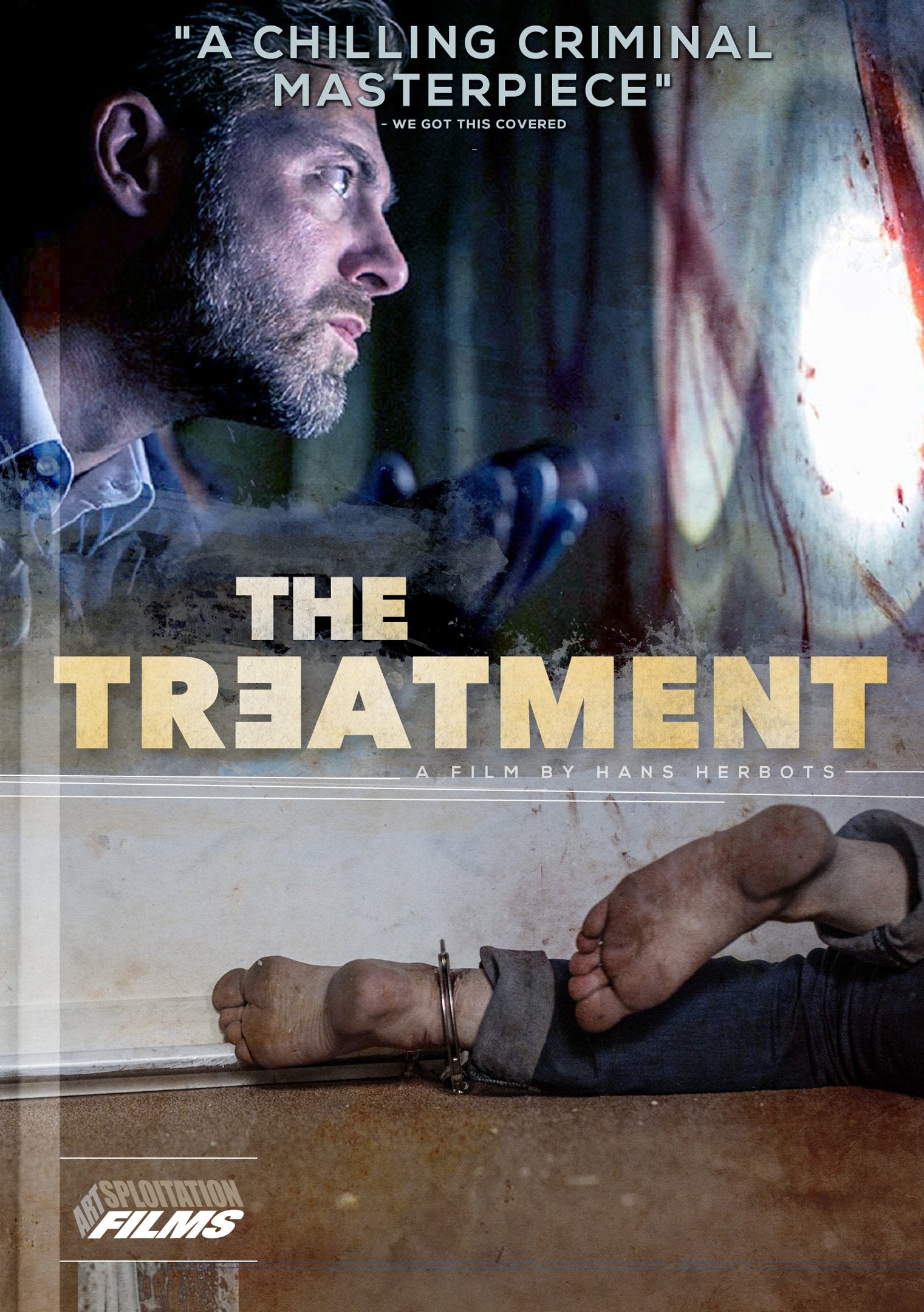 The Treatment (DVD)