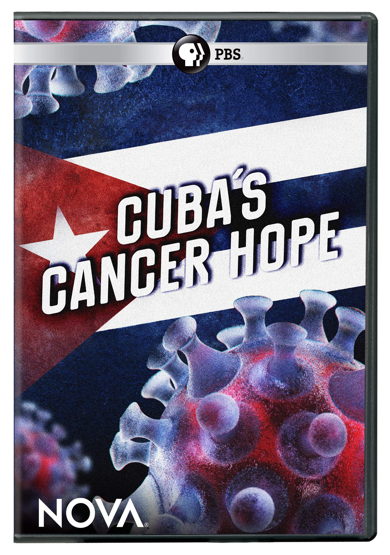 Nova: Cuba's Cancer Hope (DVD)